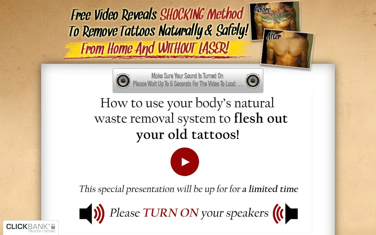 The Laserless Tattoo Removal Guide