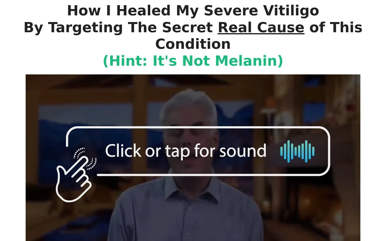 Vitiligo Miracle